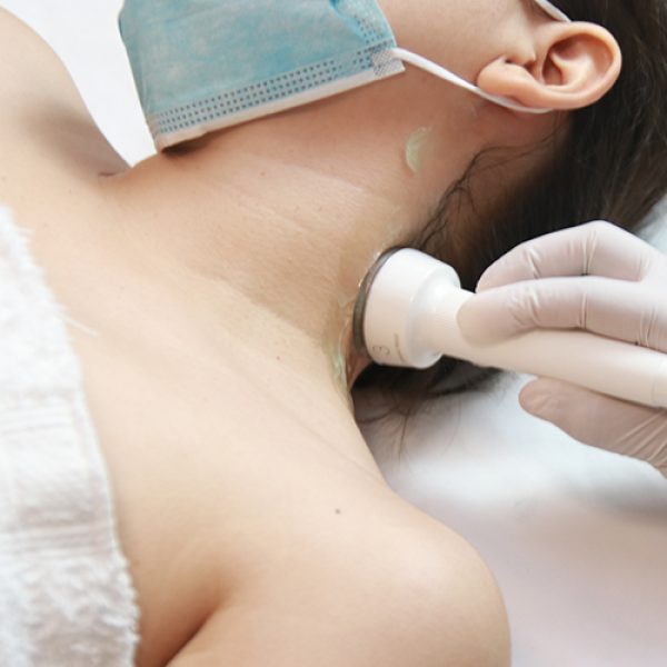 Cuello